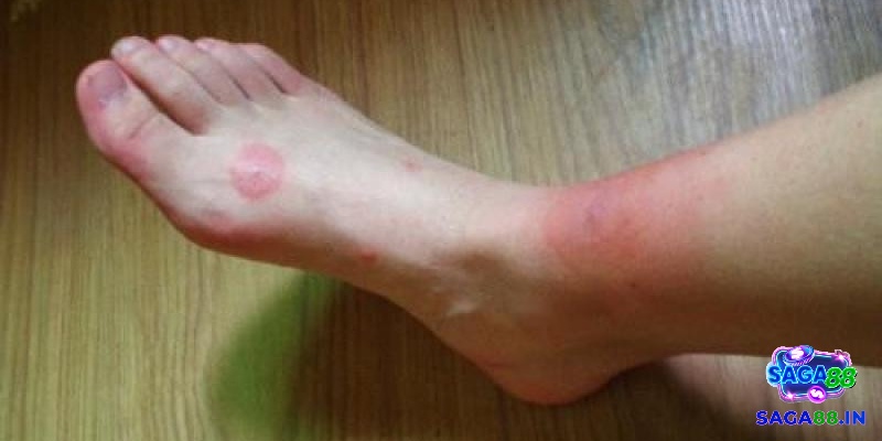 Giải mã giấc mơ thấy rết cắn vào chân gắn liền với số 49