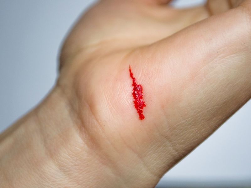 Mơ thấy chảy máu đánh con gì? Điềm báo và con số may mắn